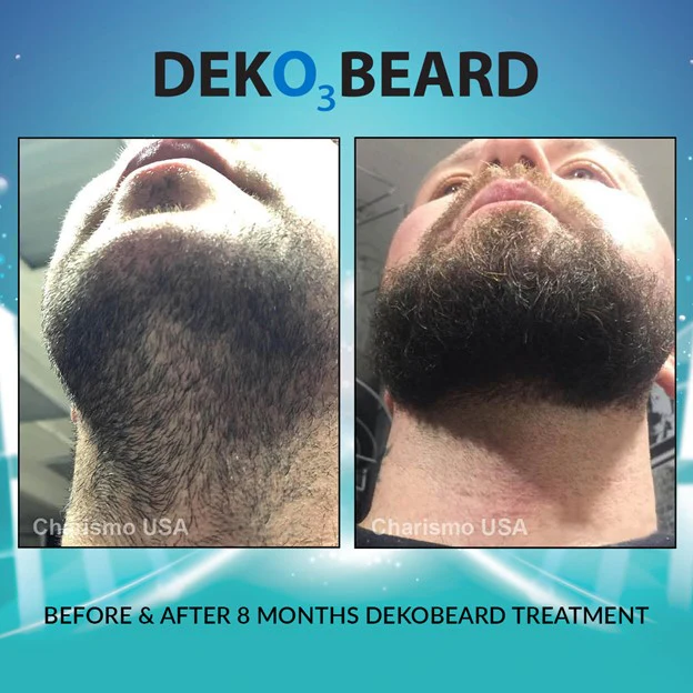 DEKOBEARD 30mL - Image 3